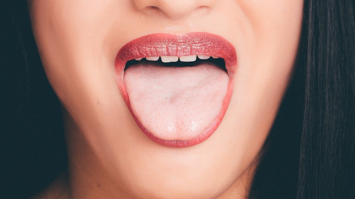 What Is A Tongue-Tie?