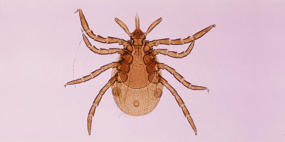 Lyme Disease – Causes, Symptoms, Screening, and Treatments
