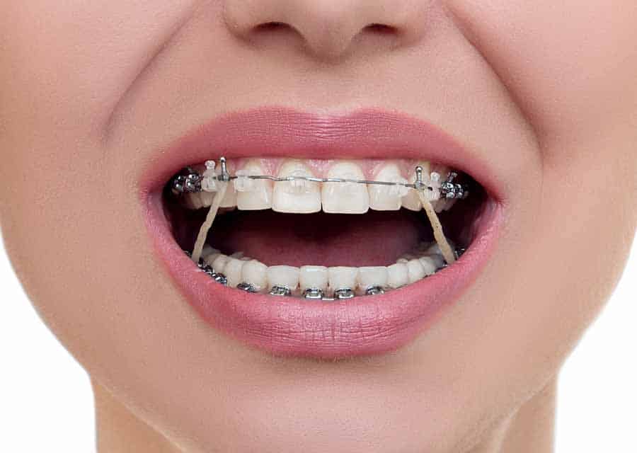 orthodontic-treatment