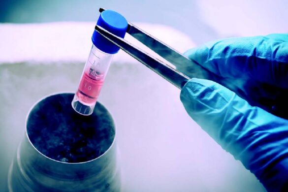 Important Information You Should Know About Stem Cells Therapy