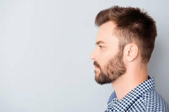 Should You Get a Hair Transplant