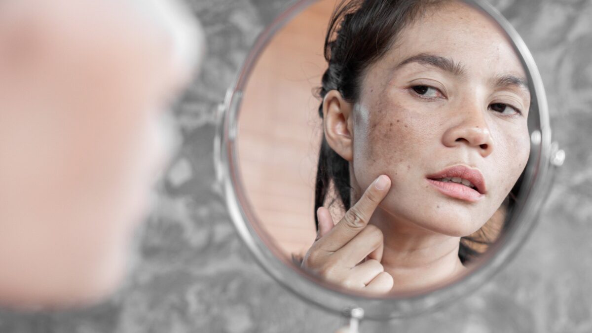 Five Reasons Why People May Develop Skin Problems