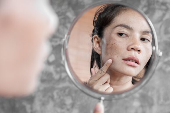 Five Reasons Why People May Develop Skin Problems