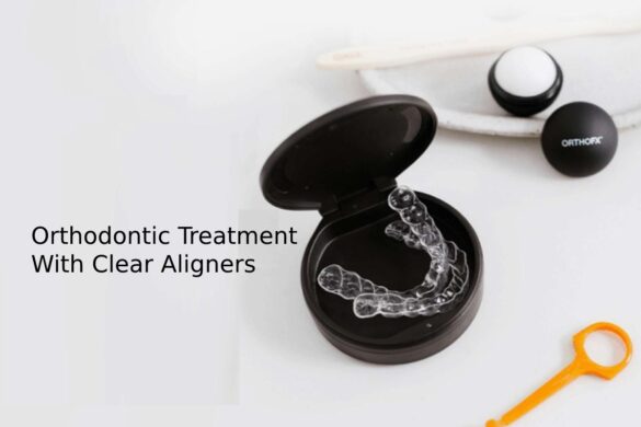 Orthodontic Treatment With Clear Aligners