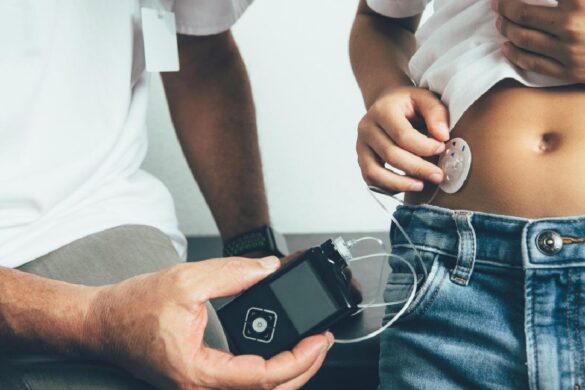 4 Types of Insulin Pumps and How They Work
