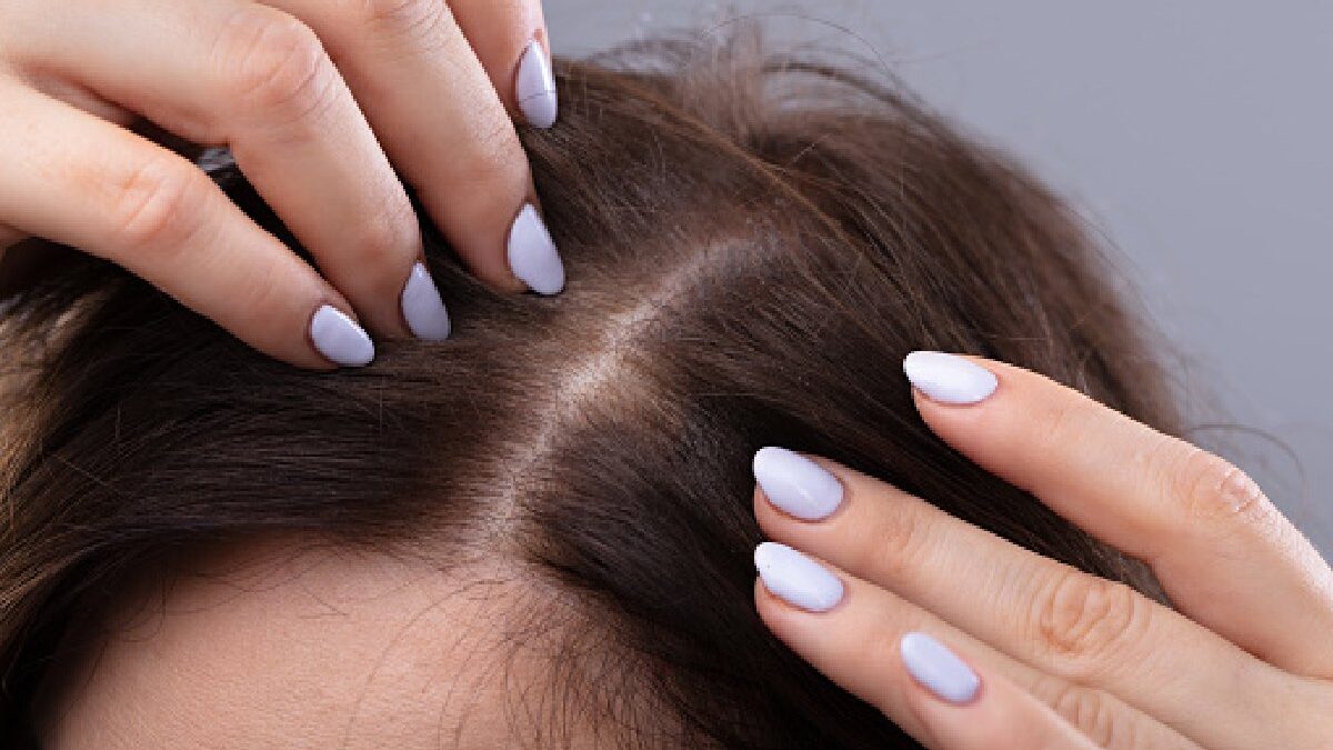 4 Ways Women Can Deal With Thinning Hair
