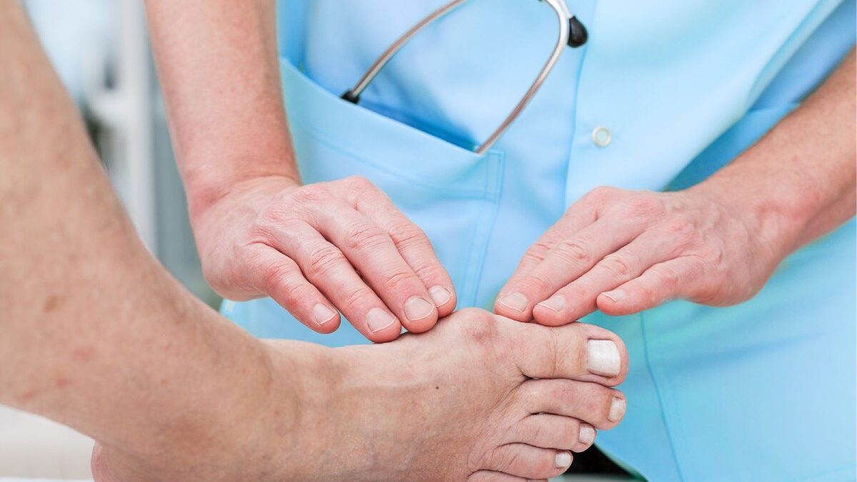 Tips on How to Treat a Bunion Your Foot