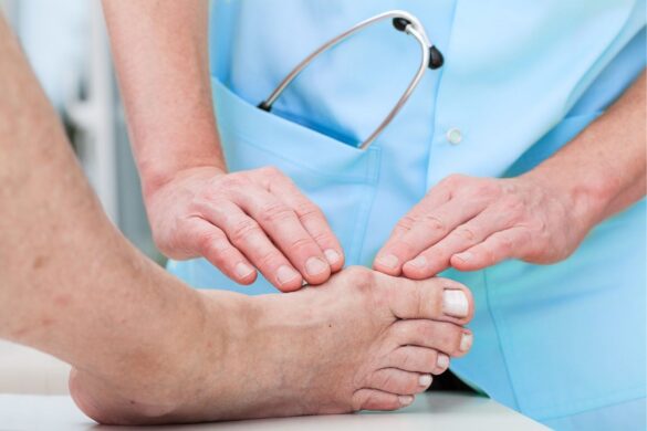 tips on how to treat a bunion your foot