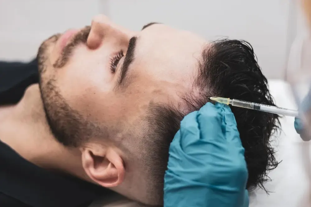 guide to fue hair transplants