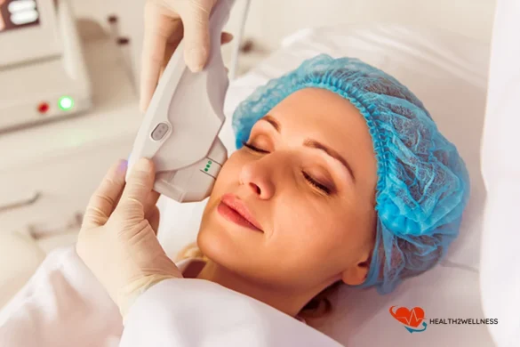 sculpted facial contours through modern hifu therapy